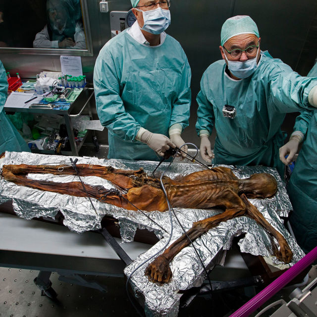 Jäämies Ötzin murhamysteeri